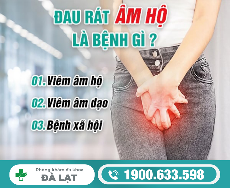 Hình ảnh minh họa